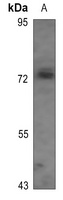TAU (Phospho-T522) Rabbit Polyclonal Antibody