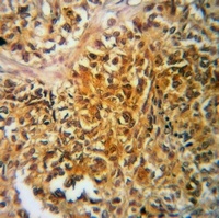 TAU (Phospho-T522) Rabbit Polyclonal Antibody