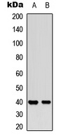 MCL1 (Phospho-S159) Rabbit Polyclonal Antibody