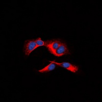 MCL1 (Phospho-S159) Rabbit Polyclonal Antibody