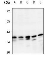 CRSP8 Rabbit Polyclonal Antibody