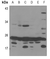 MRPS25 Rabbit Polyclonal Antibody