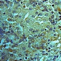 MRPS25 Rabbit Polyclonal Antibody