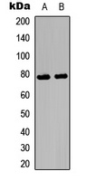 Ezrin/Radixin/Moesin (Phospho-T567/564/558) Rabbit Polyclonal Antibody