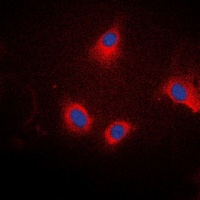 Ezrin/Radixin/Moesin (Phospho-T567/564/558) Rabbit Polyclonal Antibody