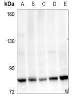 MYBL2 Rabbit Polyclonal Antibody