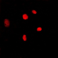 MYBL2 Rabbit Polyclonal Antibody