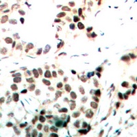 c-Myc (Phospho-T358) Rabbit Polyclonal Antibody