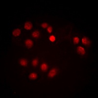 c-Myc (Phospho-T358) Rabbit Polyclonal Antibody