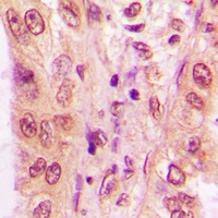 NFAT3 Rabbit Polyclonal Antibody