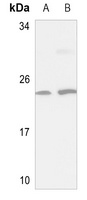 NSG1 Rabbit Polyclonal Antibody