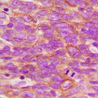 TRK A (Phospho-Y496) Rabbit Polyclonal Antibody