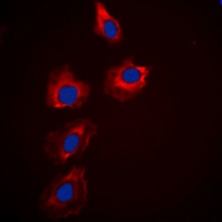 PAK1/2/3 Rabbit Polyclonal Antibody