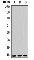PEA15 (Phospho-S104) Rabbit Polyclonal Antibody