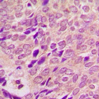 PEA15 (Phospho-S104) Rabbit Polyclonal Antibody