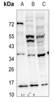 PEA15 Rabbit Polyclonal Antibody