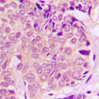 PEA15 Rabbit Polyclonal Antibody