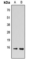 PEA15 Rabbit Polyclonal Antibody