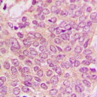PEA15 Rabbit Polyclonal Antibody