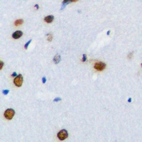 PLK1 Rabbit Polyclonal Antibody