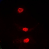 PLK1 Rabbit Polyclonal Antibody