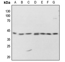 PKA C alpha/beta/gamma (Phospho-T198) Rabbit Polyclonal Antibody