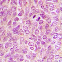 PKA C alpha/beta/gamma (Phospho-T198) Rabbit Polyclonal Antibody