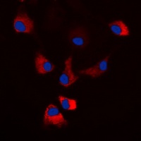 PKA C alpha/beta/gamma (Phospho-T198) Rabbit Polyclonal Antibody