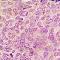 PKC alpha Rabbit Polyclonal Antibody