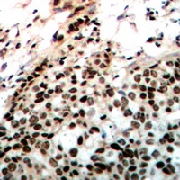 DNA-PKcs (Phospho-T2647) Rabbit Polyclonal Antibody
