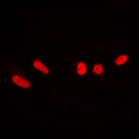 DNA-PKcs (Phospho-T2647) Rabbit Polyclonal Antibody