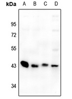 GPR73a Rabbit Polyclonal Antibody