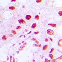 RAD51D Rabbit Polyclonal Antibody