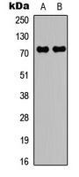 c-RAF (Phospho-S43) Rabbit Polyclonal Antibody