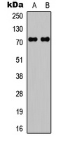 c-RAF Rabbit Polyclonal Antibody