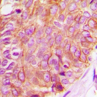 c-RAF Rabbit Polyclonal Antibody
