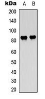 c-Raf/B-RAF (Phospho-T491/599) Rabbit Polyclonal Antibody