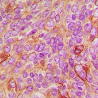 c-Raf/B-RAF (Phospho-T491/599) Rabbit Polyclonal Antibody
