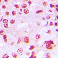 ROR alpha Rabbit Polyclonal Antibody