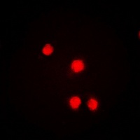 ROR alpha Rabbit Polyclonal Antibody