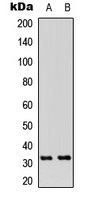 RPA2 (Phospho-T21) Rabbit Polyclonal Antibody