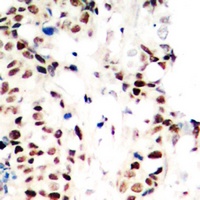 RPA2 (Phospho-T21) Rabbit Polyclonal Antibody