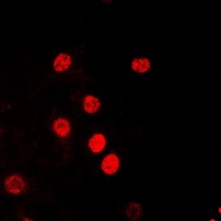 RPA2 (Phospho-T21) Rabbit Polyclonal Antibody