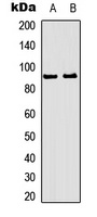 RSK1/2/3 (Phospho-T573/570/577) Rabbit Polyclonal Antibody