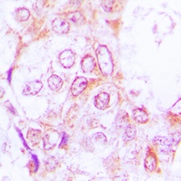 RSK1/2/3 (Phospho-T573/570/577) Rabbit Polyclonal Antibody