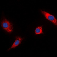 RSK1/2/3 (Phospho-T573/570/577) Rabbit Polyclonal Antibody