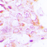 S6K1 (Phospho-T229) Rabbit Polyclonal Antibody