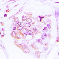 S6K1 (Phospho-T412) Rabbit Polyclonal Antibody
