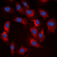 S6K1 (Phospho-T412) Rabbit Polyclonal Antibody