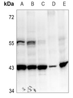 PEDF Rabbit Polyclonal Antibody